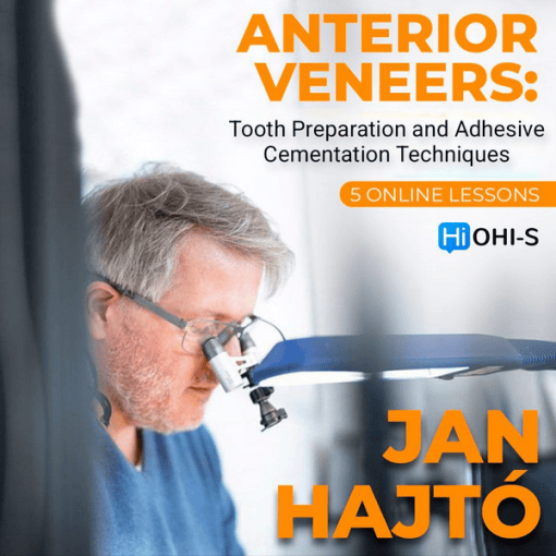 Anterior Veneer: Tooth Preparation and Adhesive Cementation Techniques - Dental Courses | كورسات طب اسنان