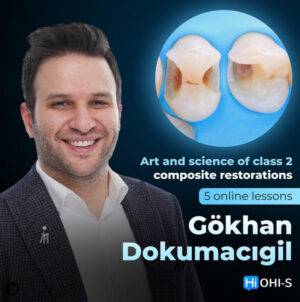Art and Science of Class 2 Composite Restorations - Dental Courses | كورسات طب اسنان
