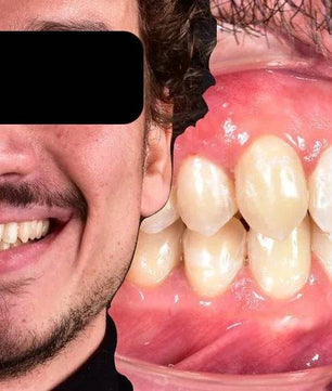 Ceramic Layering: Protocols of the World’s Leading Schools - Dental Courses | كورسات طب اسنان