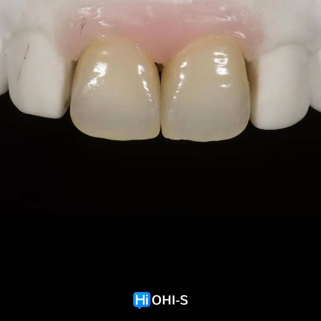 Ceramic Layering: Protocols of the World’s Leading Schools - Dental Courses | كورسات طب اسنان