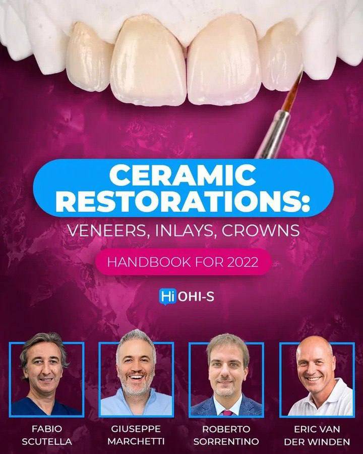 Ceramic Restorations:  Veneers, Inlays, Crowns - Dental Courses | كورسات طب اسنان