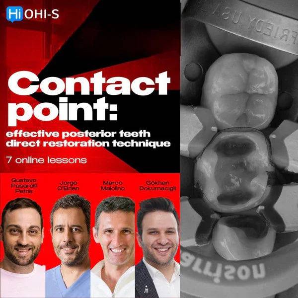 Contact Point: Effective Posterior Teeth Direct Restoration Technique - Dental Courses | كورسات طب اسنان