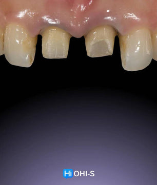 Ceramic Layering: Protocols of the World’s Leading Schools - Dental Courses | كورسات طب اسنان