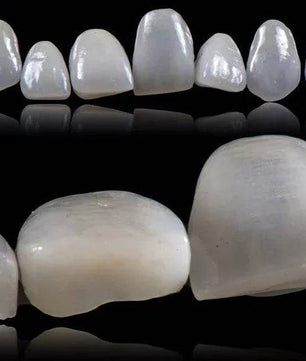 Ceramic Layering: Protocols of the World’s Leading Schools - Dental Courses | كورسات طب اسنان