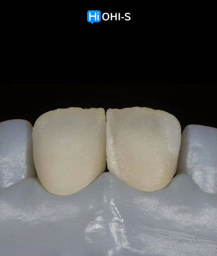 Ceramic Layering: Protocols of the World’s Leading Schools - Dental Courses | كورسات طب اسنان