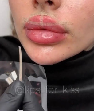 LIPS FOR KISS DIAMOND PACK - THE ULTIMATE AESTHETIC MASTERY COLLECTION