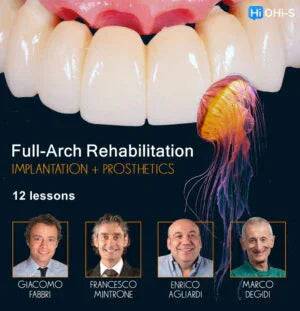 Full-Arch Rehabilitation: Implantation and Prosthetics - Dental Courses | كورسات طب اسنان