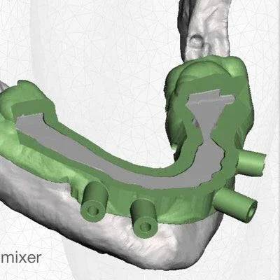 Advanced Implant Planning Course (Full Arch with Blue Sky and Meshmixer) - Dental Courses | كورسات طب اسنان