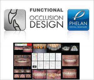 Functional Occlusion Design Dental Seminars (Full Bonus Package) - Dental Courses | كورسات طب اسنان