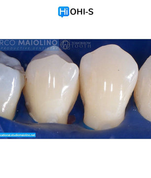 Bioclear Dental Restoration - Dental Courses | كورسات طب اسنان