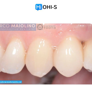 Bioclear Dental Restoration - Dental Courses | كورسات طب اسنان