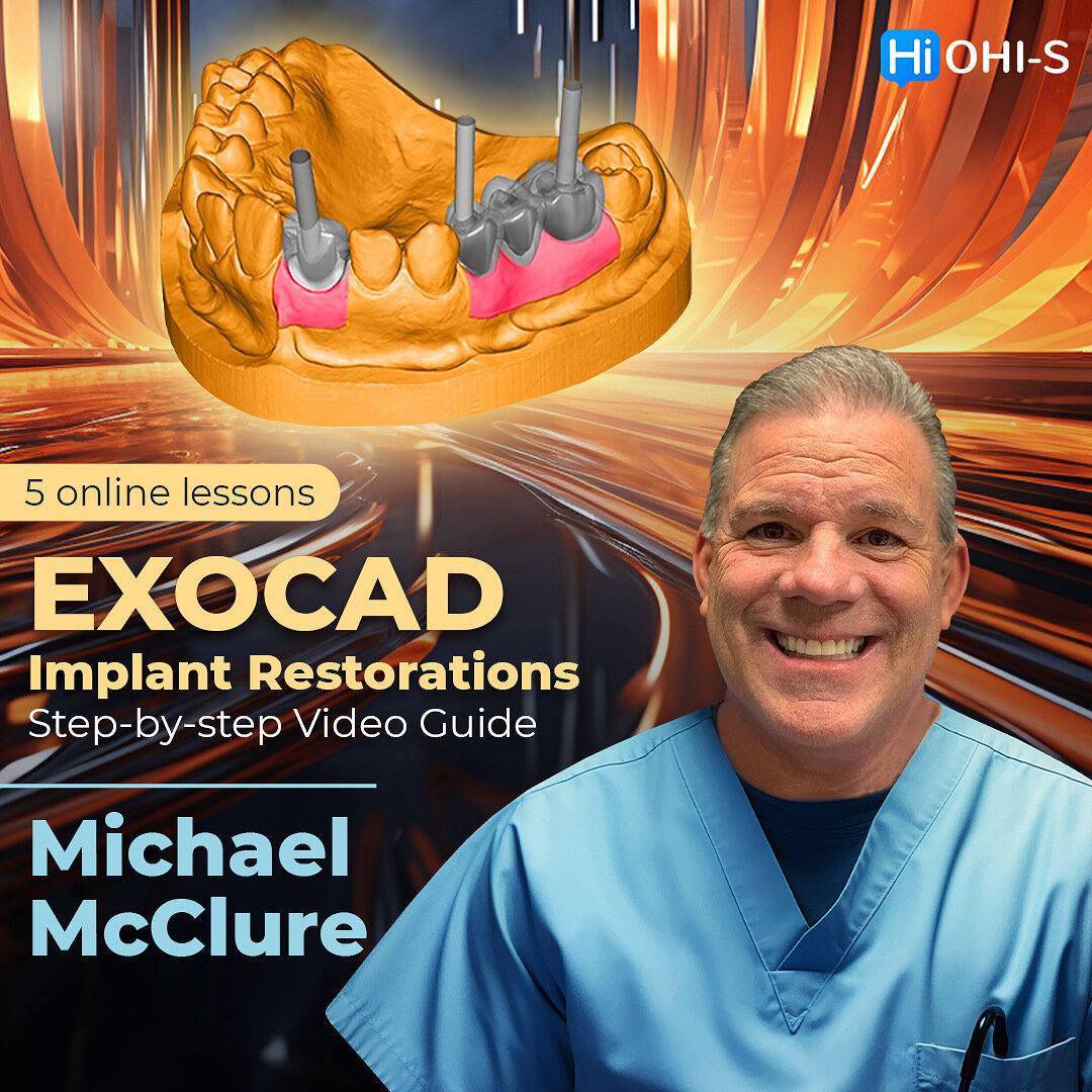 EXOCAD Implant Restorations: Step-by-step Video Guide - Dental Courses | كورسات طب اسنان