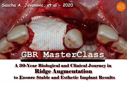 Guided Bone Regeneration: A 30 year Biological and Clinical Journey in Ridge Augmentation - Dental Courses | كورسات طب اسنان