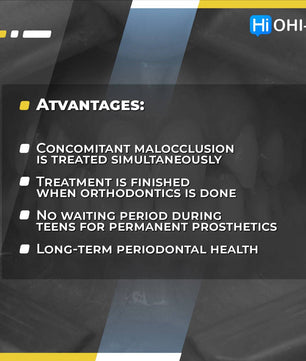 Missing Maxillary Lateral Incisors: Space Closure in all Malocclusions vs Implants and Prosthetic Replacement - Dental Courses | كورسات طب اسنان