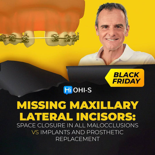 Missing Maxillary Lateral Incisors: Space Closure in all Malocclusions vs Implants and Prosthetic Replacement - Dental Courses | كورسات طب اسنان