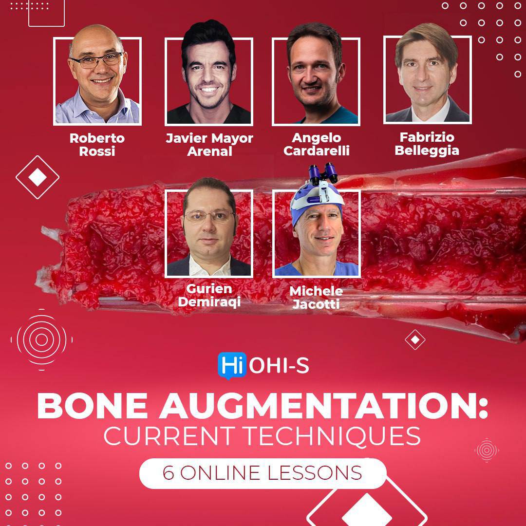 OHI-S Bone Augmentation Current Techniques - Dental Courses | كورسات طب اسنان