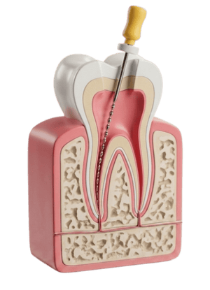 Endodontics