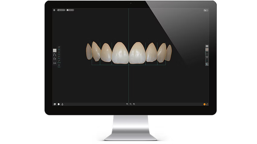 Smile Designer PRO 3.4 Installation Service (1 PC)