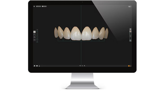 Smile Designer PRO 3.4 Installation Service (1 PC)