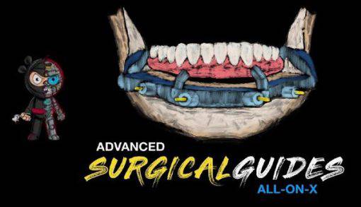 Implant Ninja, Advanced Surgical Guides – All on X – Dental Videos - Dental Courses | كورسات طب اسنان