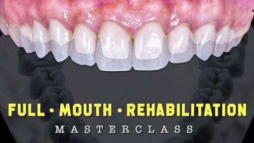 FMR – Full Course – Dr. Moez Khakiani (New online version with 2024 updates) - Dental Courses | كورسات طب اسنان