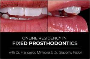 Online Residency Program in Fixed Prosthodontics: Esthetic and Functional Rehabilitation of Natural Teeth - Dental Courses | كورسات طب اسنان
