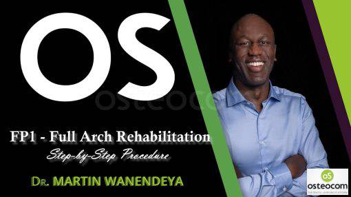 Osteocom FP1 – Full Arch Rehabilitation Step-by-Step Procedure - Dental Courses | كورسات طب اسنان