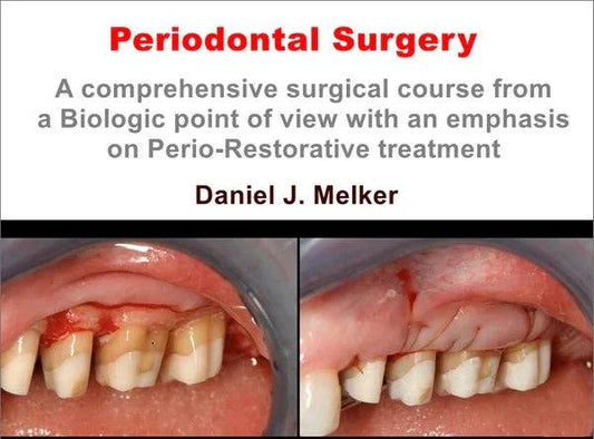 Periodontal Surgery: A Comprehensive Surgical Course - Dental Courses | كورسات طب اسنان