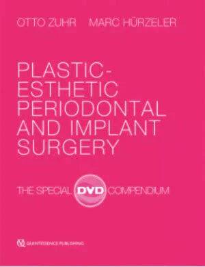 Plastic-Esthetic Periodontal and Implant Surgery: The Special DVD Compendium - Dental Courses | كورسات طب اسنان