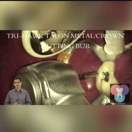Retreatment in Endodontics – Certificate Course - Dental Courses | كورسات طب اسنان