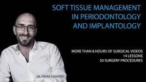 Soft Tissue Management in Periodontology and Implantology - Dental Courses | كورسات طب اسنان