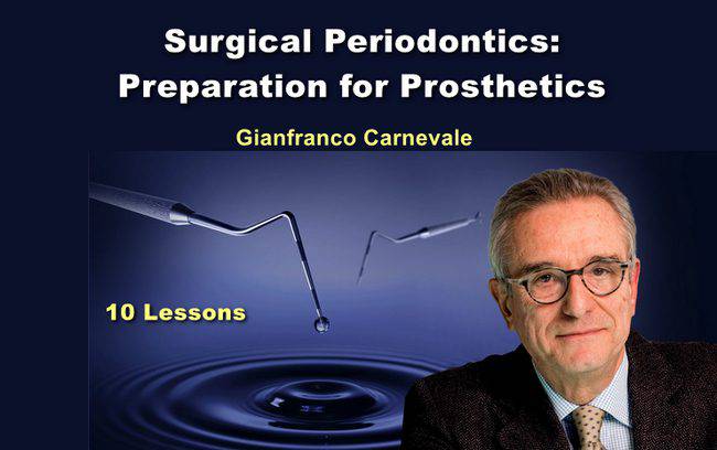 Surgical Periodontics: Preparation for Prosthetics - Dental Courses | كورسات طب اسنان