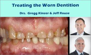 Treating the Worn Dentition Course - Dental Courses | كورسات طب اسنان