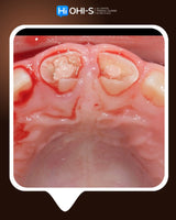 Dental Trauma Without Drama