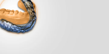 OCTA Concept: Occlusal Architecture to Secure Orthodontic or Prosthodontic Treatments