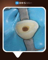 Dental Trauma Without Drama