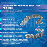 Aligners: Early Orthodontic Treatment