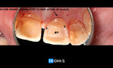 Advanced Periodontology: Surgical Protocols
