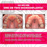 Challenging orthodontic cases: the use of skeletal anchorage