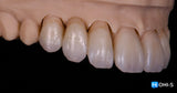 Aesthetic Dentistry Online Congress: Programs by Klaus Müterthies, Edris Rasta and Maurizio De Stefano