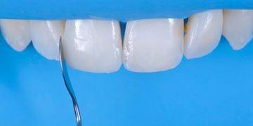Aesthetic Dentistry Congress in Milan: Difficult cases in esthetic dentistry