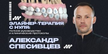Aligner therapy from scratch: a complete guide and clinical protocols
