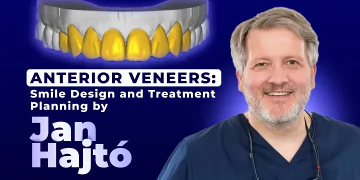Anterior Veneers: Smile Design and Treatment Planning by Jan Hajtó