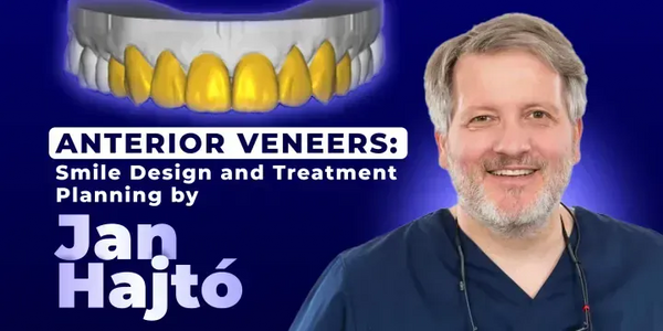 Anterior Veneers: Smile Design and Treatment Planning by Jan Hajtó