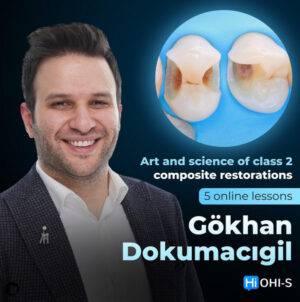 Art and Science of Class 2 Composite Restorations