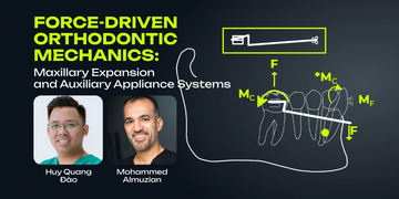Force‑Driven Orthodontic Mechanics: Maxillary Expansion and Auxiliary Appliance Systems
