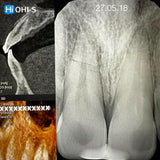 Dental Trauma Without Drama