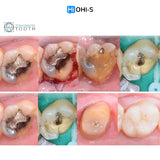 Saving Hopeless Teeth: Surgical and Conservative Protocols