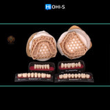 Removable dentures for dentists and technicians
