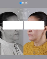 Centric Relation: All Methods of Registration and Clinical Application